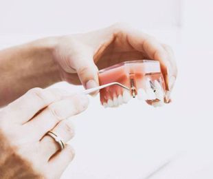 Endodoncias y prótesis