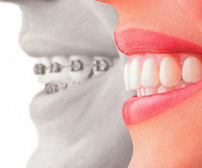 Ortodoncia: Servicios de Clínica Dental Irudent