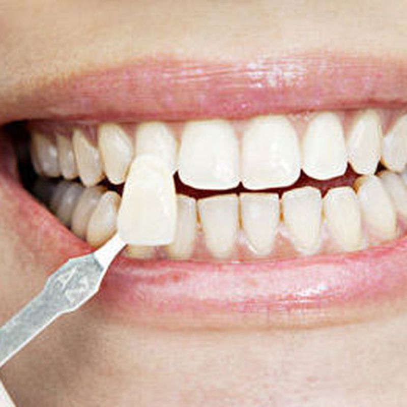 Clínica dental española / británica: Servicios de Centro Médico Fuengirola