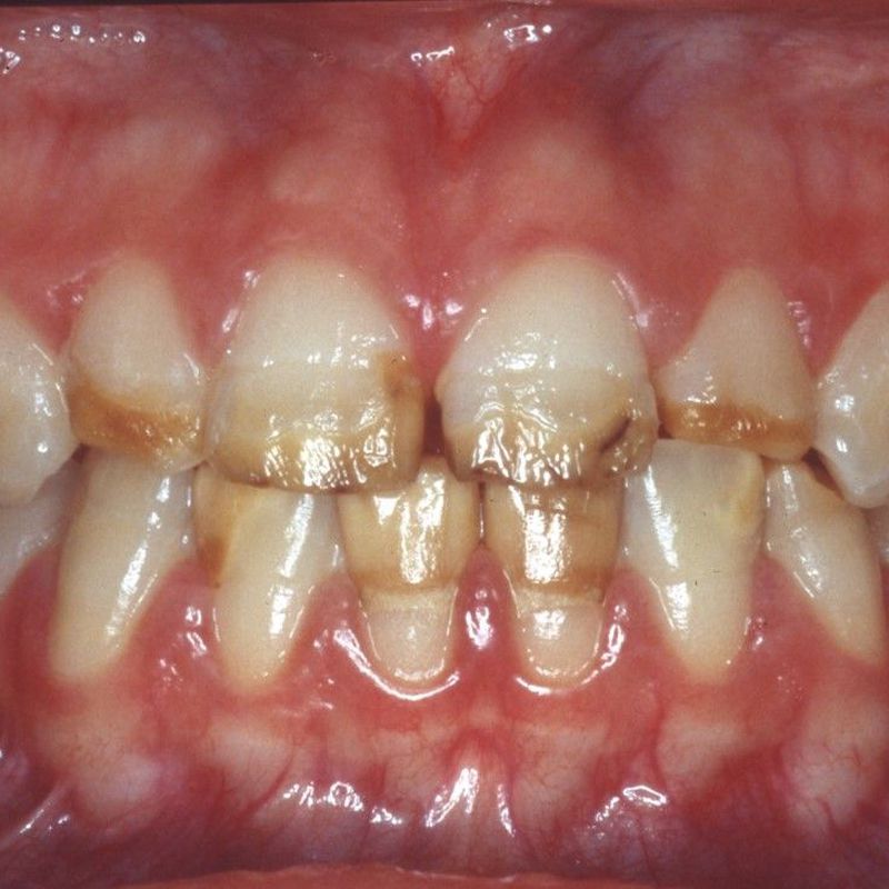Estética dental: Especialidades odontológicas de Clínica Dental Gil Nieto
