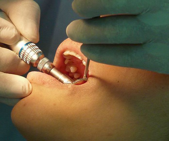 Cirugía e implantes dentales: Servicios de Clínica Dental Gregori Lloria