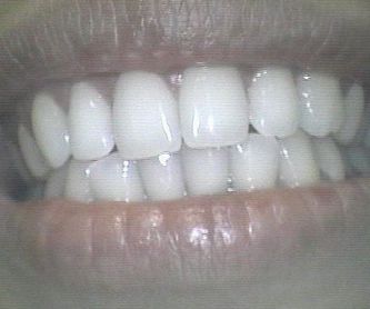 Ortodoncia: Catálogo de Clínica Dental Cuesta y Ruisánchez, S.L.