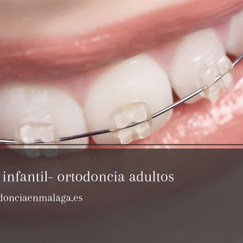 Clínica de Ortodoncia Pedro Moreno | Presupuesto de ortodoncia en Málaga