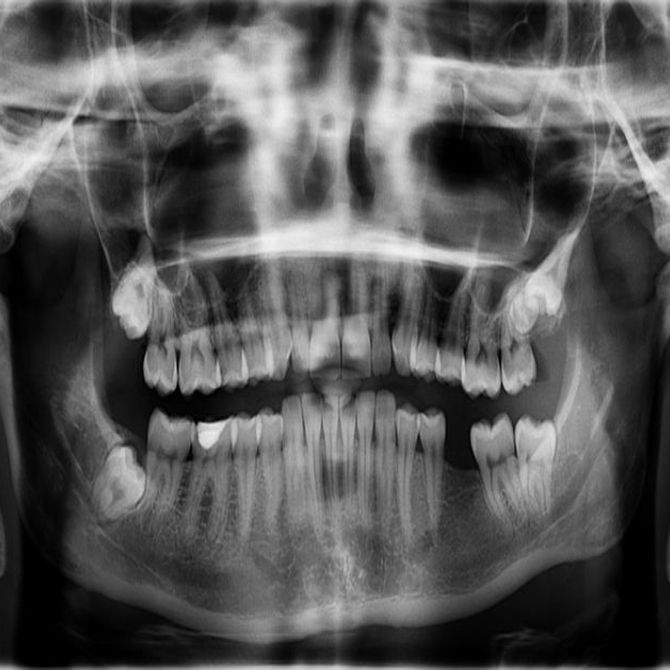 Nuestras radiografías dentales panorámicas