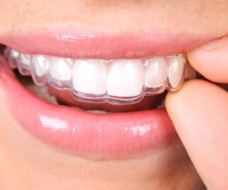 Estética dental: Servicios de CEO Clínica Dental