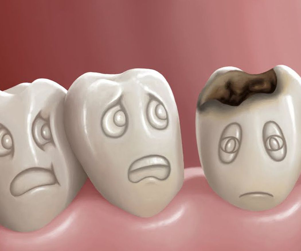 Las urgencias dentales más frecuentes
