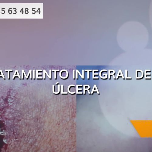 Tratamiento de úlceras varicosas en Lugo | Dr. Antonio Barreiro Mouro