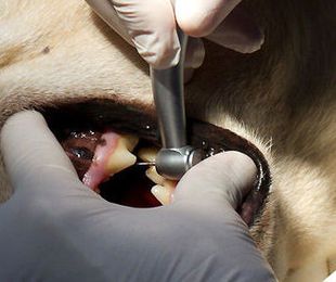Limpieza dental con ultrasonidos 