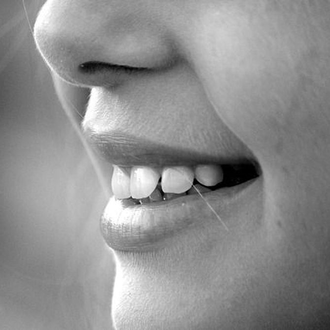 Cómo cuidar los dientes tras un implante dental