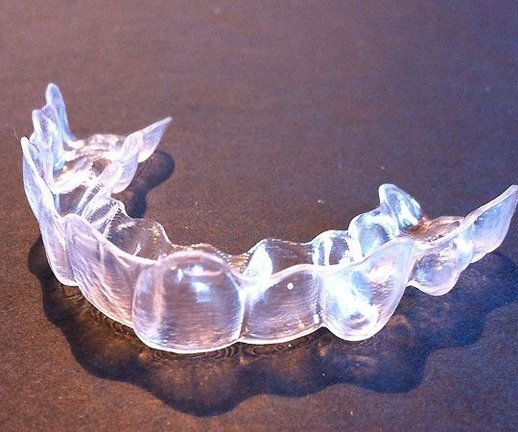 Las ventajas de la ortodoncia invisible