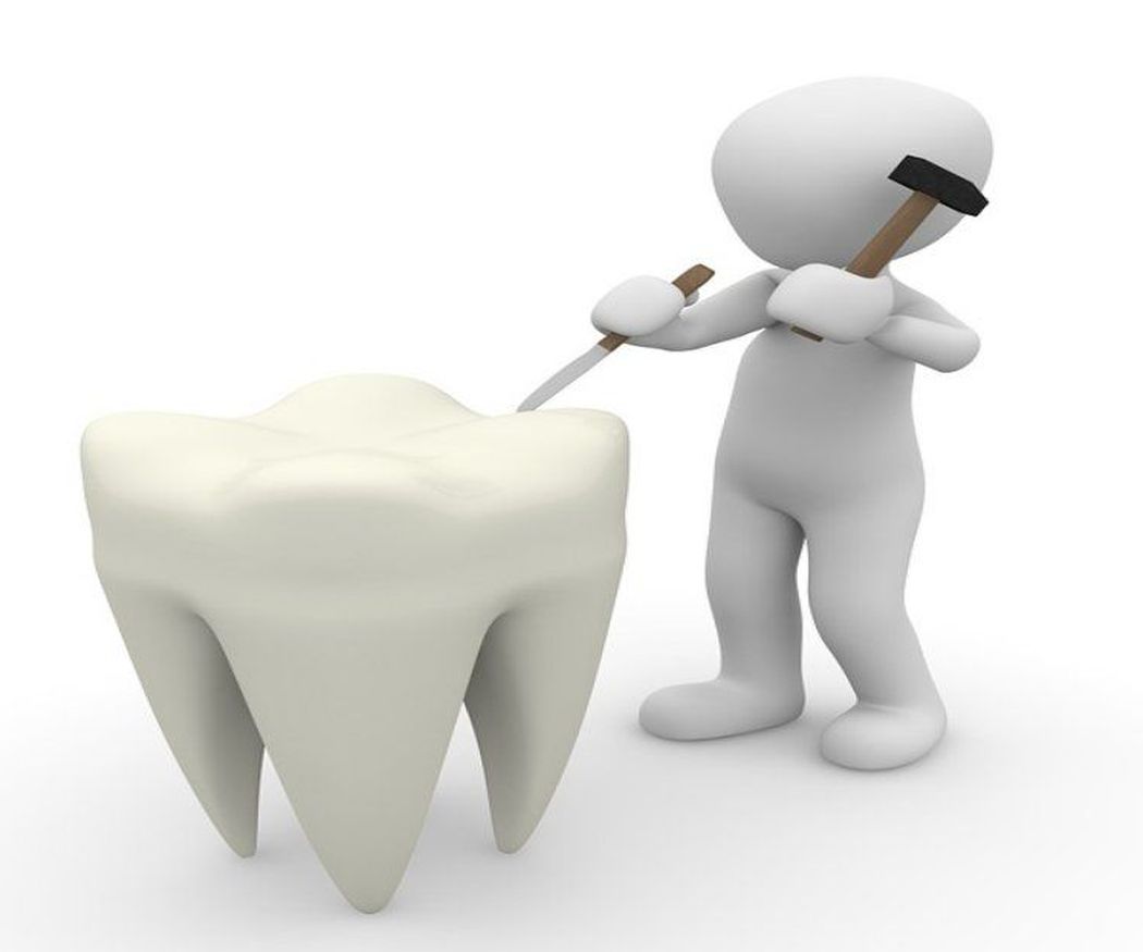 Los cuidados tras una endodoncia