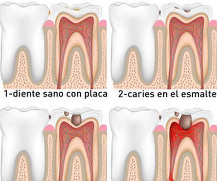 Endodoncia: Servicios de Clínica Dental Reina Victoria 23 }}