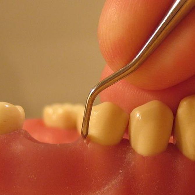 ¿Qué enfermedades trata la periodoncia?