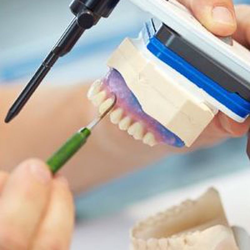 Implantología: Servicios de Ángel Dueñas Laboratorio Dental