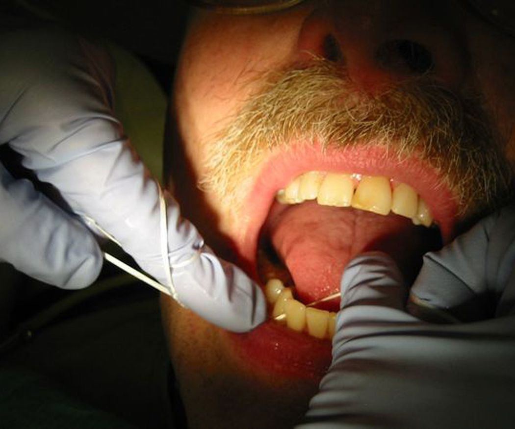 El hilo dental, indispensable en la higiene bucal