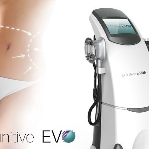 D-Finitive EVO en Santurtzi