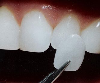 Ortodoncia fija: Tratamientos de Dental Icaria, S.L.