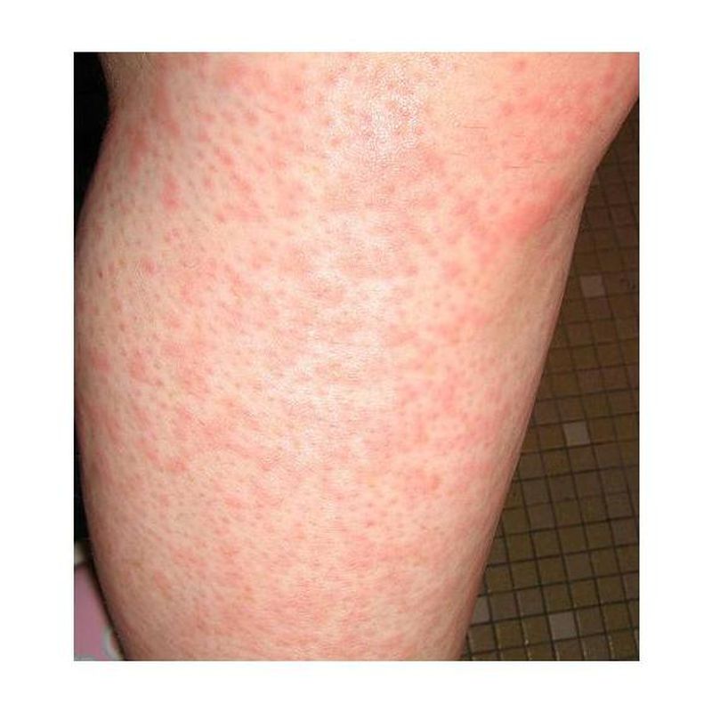 Piel: Especialidades de Dr. García Robaina Alergólogo