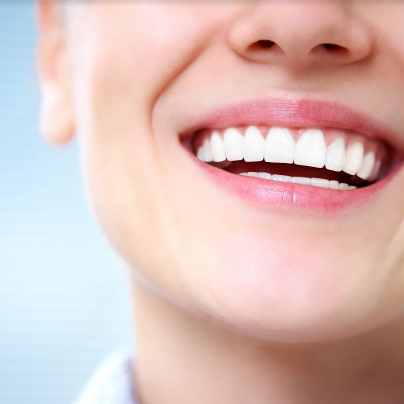 Estética dental: SERVICIOS de Altes Dental