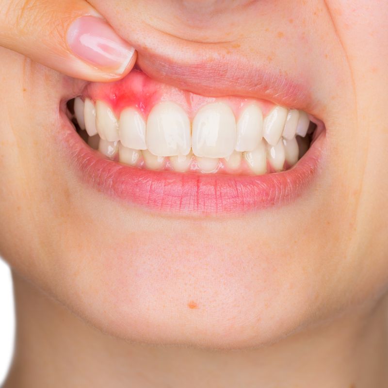 Periodoncia: Tratamientos de Clínica Dental Del Valle
