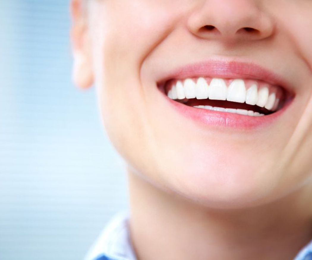Las carillas dentales: tratamiento y ventajas