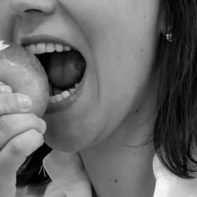 limpiezas dentales: Servicios de Clínica Dental Barakaldo
