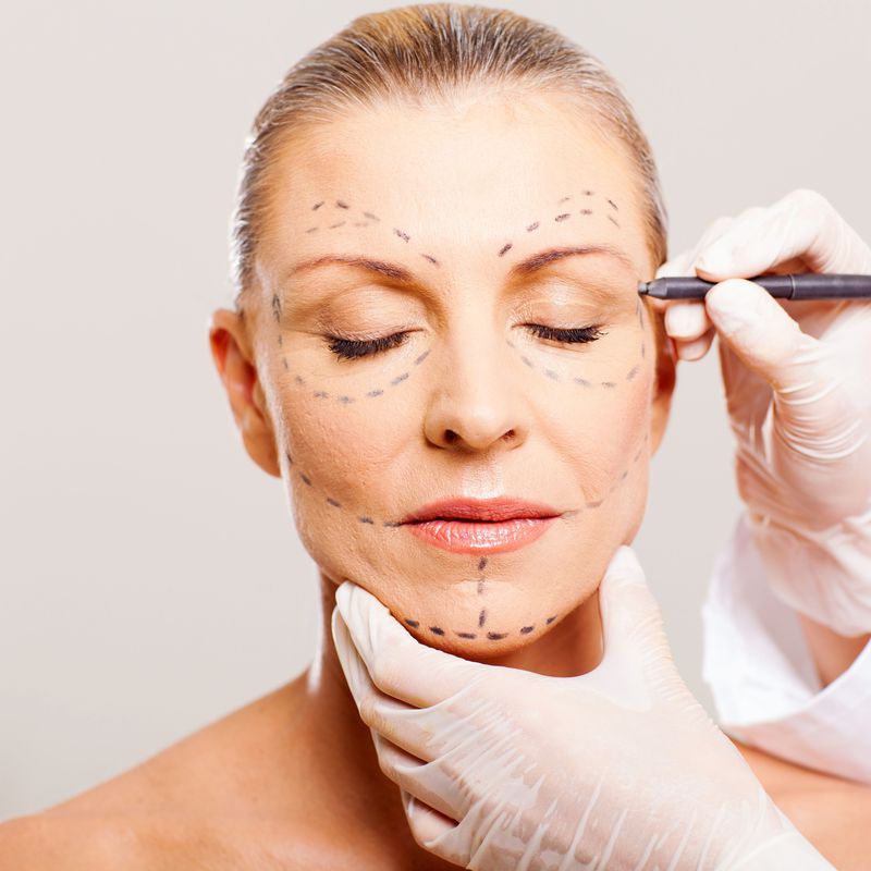 Relleno y remodelación facial: Servicios y tratamientos de Dr. Aliaga Clínica Dermatológica