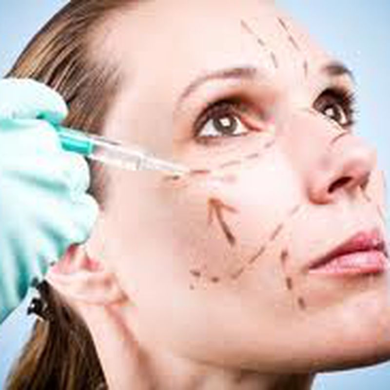 Botox: Tratamientos de Dra. Ana Vilasau