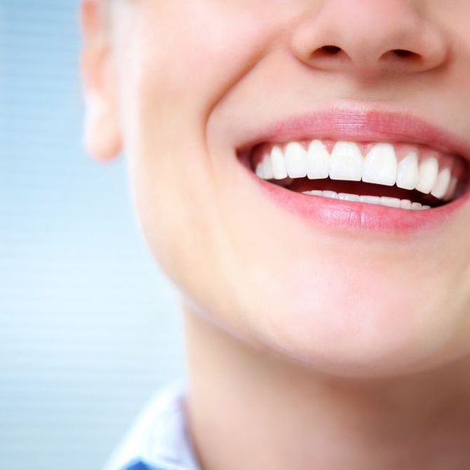 Ortodoncia invisible: La revolución en la comodidad y estética dental