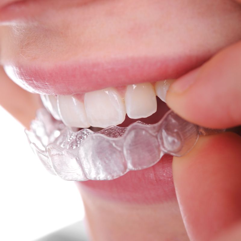 Ortodoncia invisible: Tratamientos dentales de Clínica Dental Álvaro Gómez