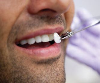 Limpieza, empastes y endodoncias: Catálogo de Centro de Salud Dental FamilDent