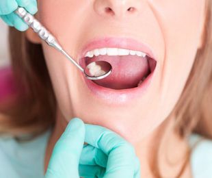 Empastes y endodoncias, ¿en qué se diferencian?