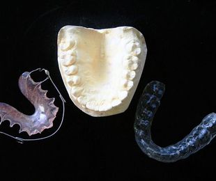 ¿En qué consiste la ortodoncia invisible y cuándo se usa?