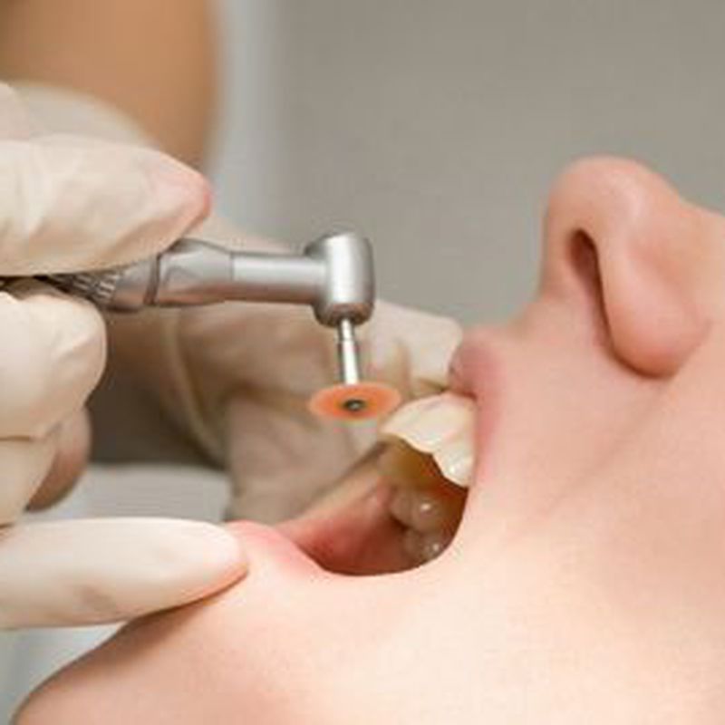 Odontología general: Servicios de Clínica Especialidades Dentales