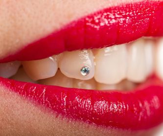 Implantología: Tratamientos de Dental Valls