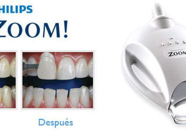Blanqueamiento dental Zoom Philips