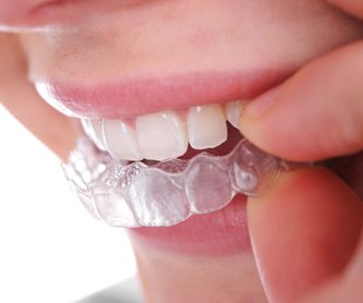 Estética dental: Tratamientos dentales de Clínica Dental Álvaro Gómez