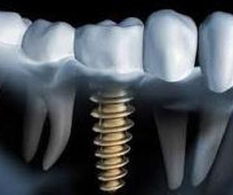 Estética dental: Tratamientos de Centre Dental Oddo
