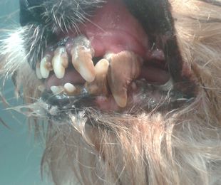 Higiene dental