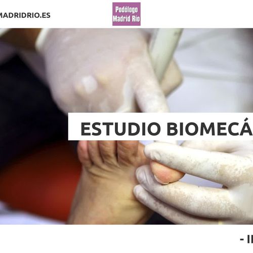 Estudio biomecánico en Madrid Río | Podólogos Madrid Río