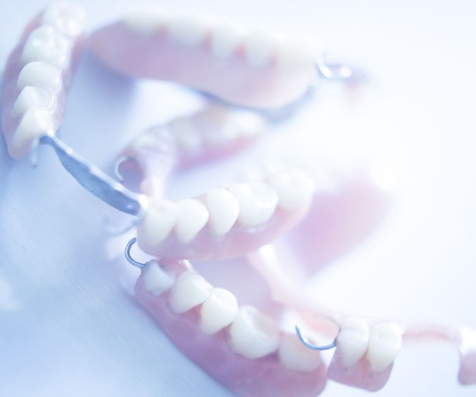 Prótesis dentales removibles: Especialidades de Clínica Dental Plaza 58 (Dr. Pedro Fernández Lorente) }}