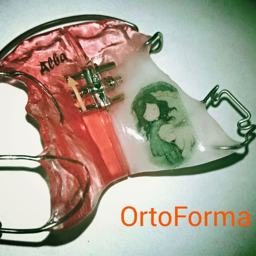 Laboratorio de ortodoncia en Valencia | Ortoforma