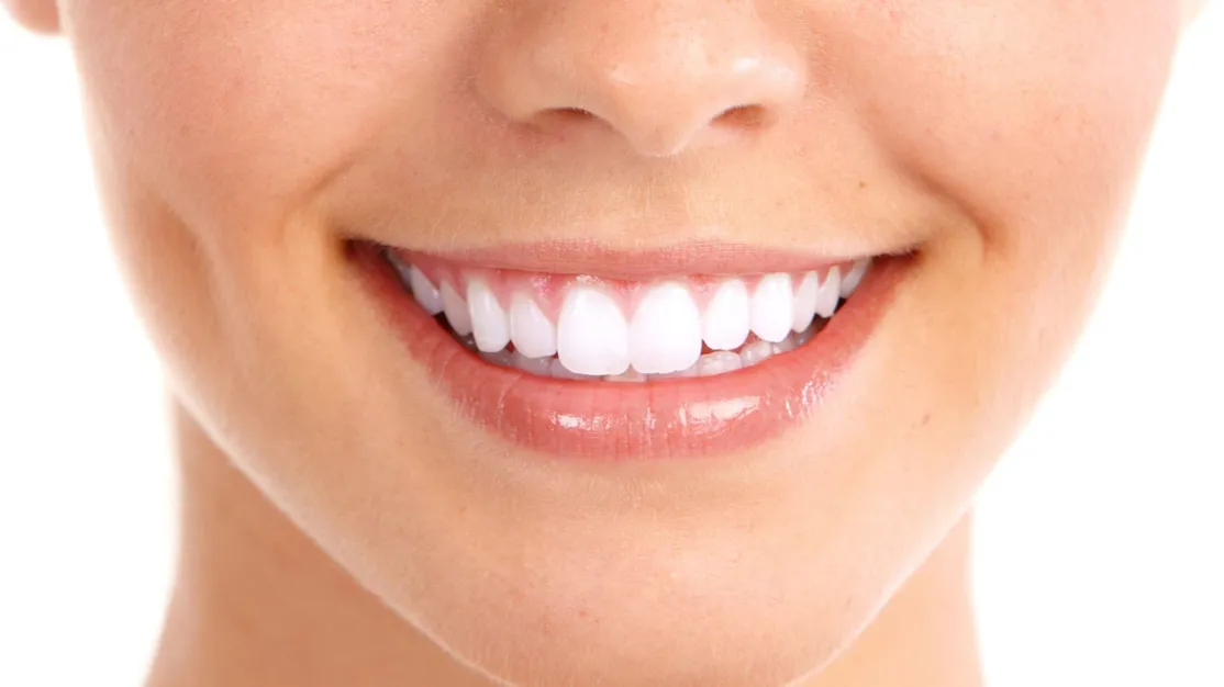 sonrisa-vitaldent