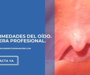 Rinoplastia precio Oviedo | Clínica ORL, Dr. Arrutia - Dr. Mancebo