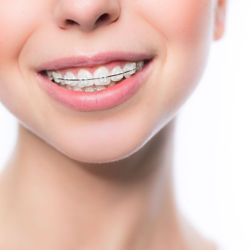 Ortodoncia: Especialidades odontológicas de Clínica Dental Gil Nieto
