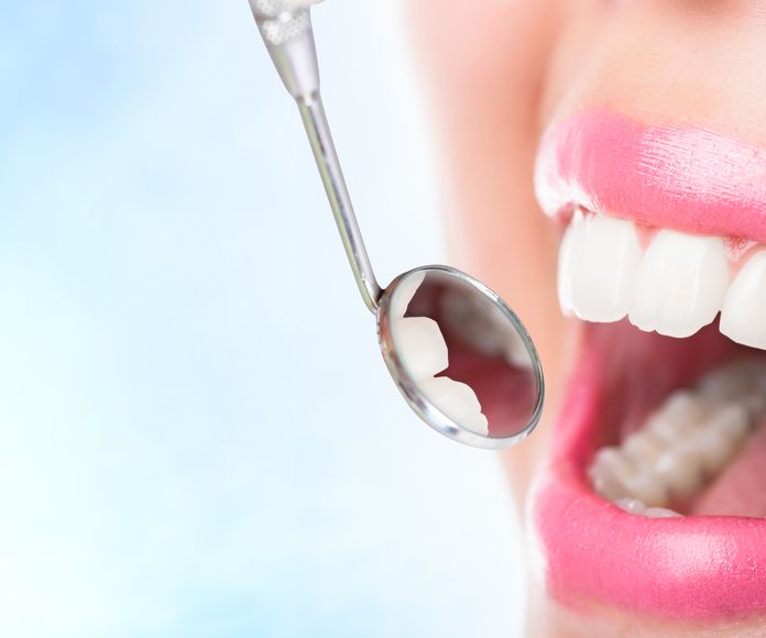 Endodoncia : Especialidades  de Clínica Dental Baviera