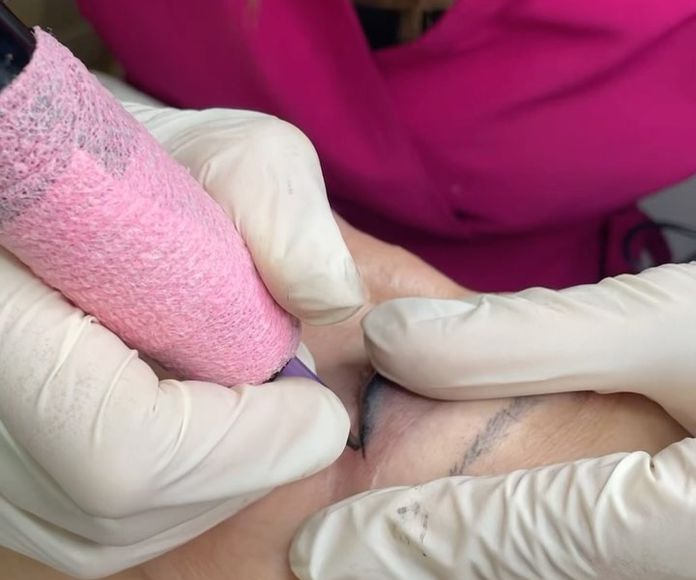 Micropigmentación perfecta