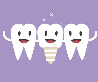 Implantes dentales: ¿qué son, qué puedo esperar de ellos y cómo cuidarlos?