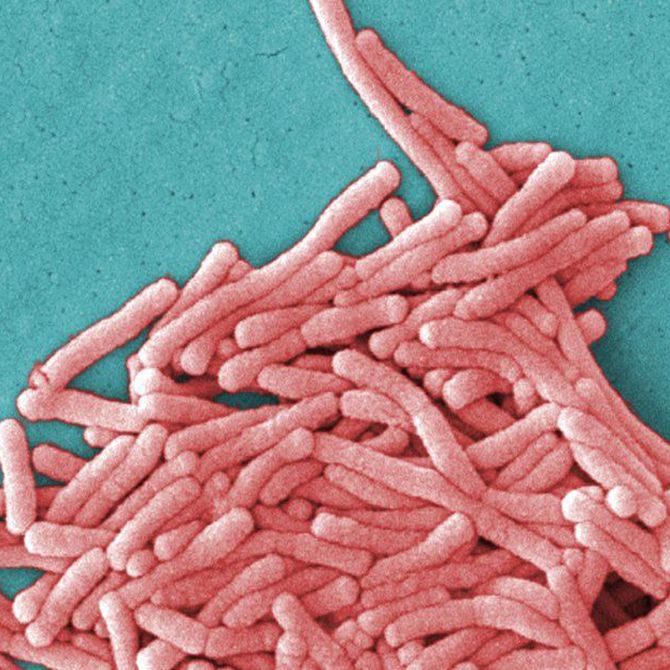 ¿Qué sabes de la Legionella? (I)