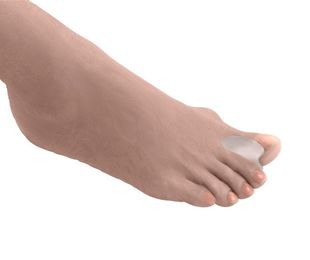 ¿Cómo aliviar las alteraciones anatómicas de tus pies?